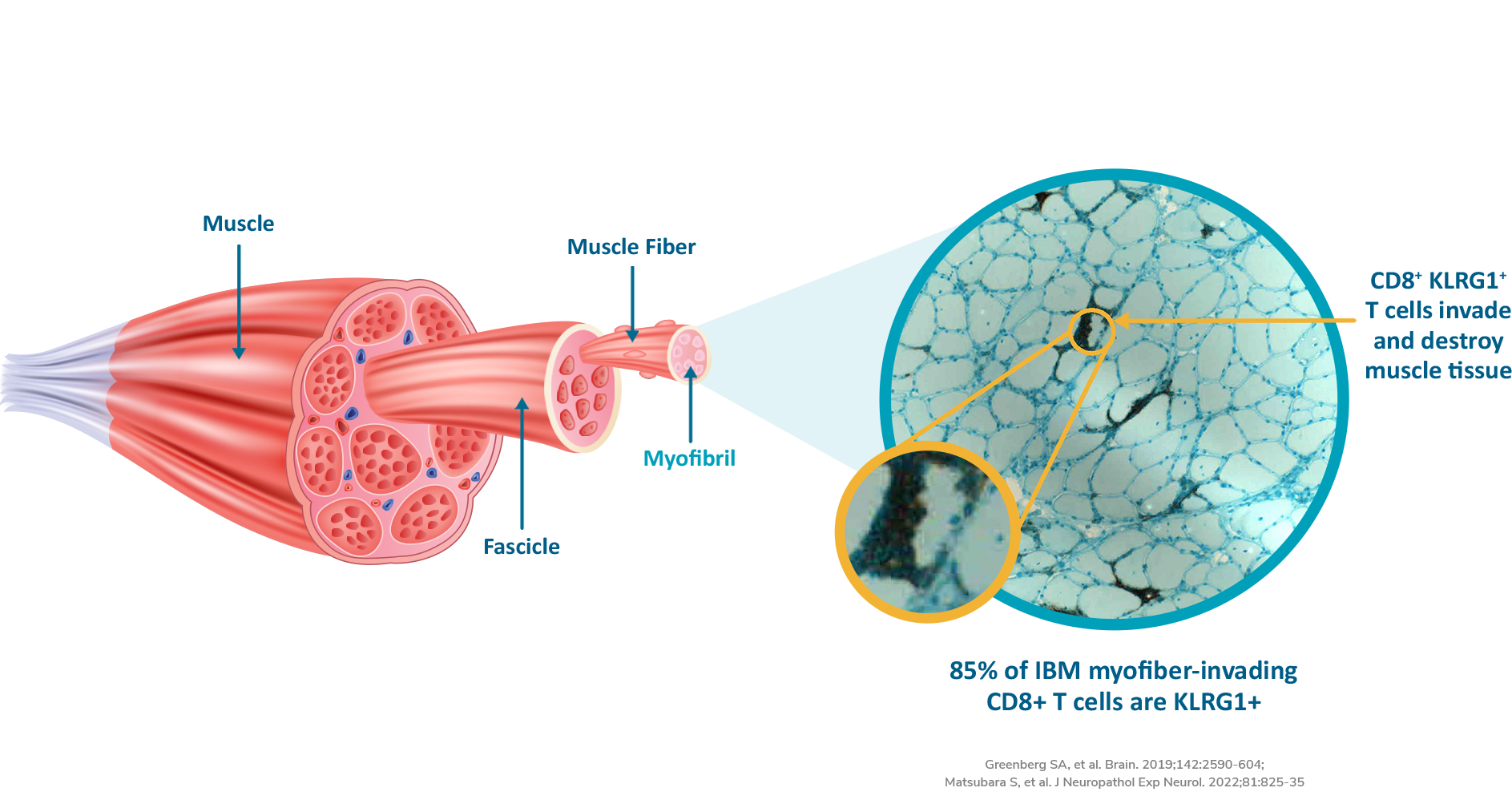 IBM-muscle-graphic